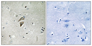 IHC of paraffin-embedded human brain tissue, using RNF149 Antibody. The picture on the right is treated with the synthesized peptide.