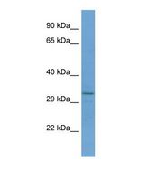 Western blot of Human Jurkat. RNF150 antibody dilution 1.0 ug/ml.