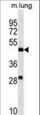 RNF150 Antibody western blot of mouse lung tissue lysates (35 ug/lane). The RNF150 Antibody detected the RNF150 protein (arrow).