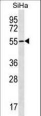 RNF150 Antibody western blot of SiHa cell line lysates (35 ug/lane). The RNF150 Antibody detected the RNF150 protein (arrow).