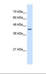 Jurkat cell lysate. Antibody concentration: 2.5 ug/ml. Gel concentration: 12%.