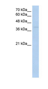 RNF165 antibody LS-C40411 Western blot of Jurkat lysate.