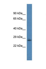 RNF166 antibody LS-C145202 Western blot of Mouse Pancreas lysate. Antibody concentration 1 ug/ml.