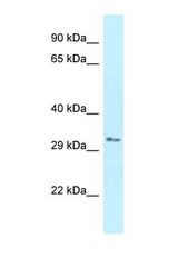 Western blot of Human Jurkat. RNF167 antibody dilution 1.0 ug/ml.