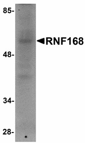 Western blot of RNF168 in human brain tissue lysate with RNF168 antibody at 1 ug/ml.
