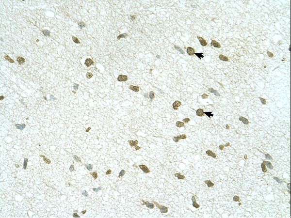 RNF168 antibody LS-C82462 was used in IHC to stain formalin-fixed, paraffin-embedded human brain.