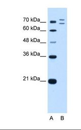 Lane A: Marker. Lane B: HepG2 cell lysate. Antibody concentration: 0.5 ug/ml. Gel concentration: 12%.