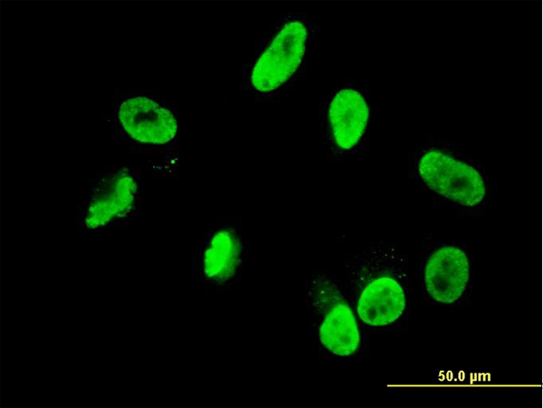 Immunofluorescence of monoclonal antibody to RNF168 on HepG2 cell. [antibody concentration 10 ug/ml]