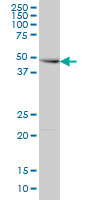 RNF168 monoclonal antibody (M01), clone 3E1 Western blot of RNF168 expression in HepG2.