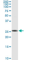 RNF170 monoclonal antibody (M01), clone 2D6. Western blot of RNF170 expression in Jurkat.