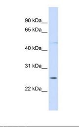 Jurkat cell lysate. Antibody concentration: 1.0 ug/ml. Gel concentration: 12%.