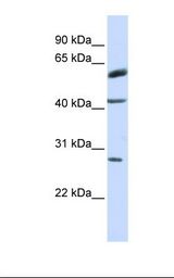 MCF7 cell lysate. Antibody concentration: 1.0 ug/ml. Gel concentration: 12%.