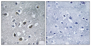 IHC of paraffin-embedded human brain tissue, using MARCH4 Antibody. The picture on the right is treated with the synthesized peptide.