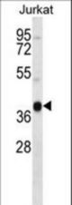 MARCH4 Antibody western blot of Jurkat cell line lysates (35 ug/lane). The MARCH4 antibody detected the MARCH4 protein (arrow).