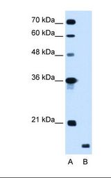 Lane A: Marker. Lane B: HepG2 cell lysate. Antibody concentration: 1.25 ug/ml. Gel concentration: 12%.