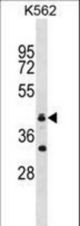 RNF175 Antibody western blot of K562 cell line lysates (35 ug/lane). The RNF175 antibody detected the RNF175 protein (arrow).