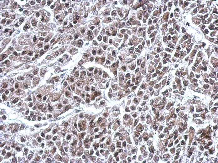IHC of paraffin-embedded HBL435 xenograft, using RNF180 antibody at 1:500 dilution.