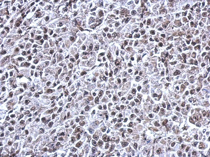 IHC of paraffin-embedded HBL435 xenograft, using RNF180 antibody at 1:500 dilution.