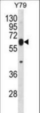 RNF180 Antibody western blot of Y79 cell line lysates (35 ug/lane). The RNF180 antibody detected the RNF180 protein (arrow).