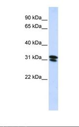 HepG2 cell lysate. Antibody concentration: 1.0 ug/ml. Gel concentration: 12%.