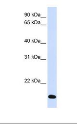 Fetal liver lysate. Antibody concentration: 1.0 ug/ml. Gel concentration: 12%.
