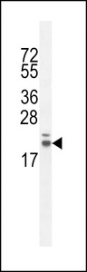 RN185 Antibody western blot of CHO cell line lysates (35 ug/lane). The RN185 antibody detected the RN185 protein (arrow).