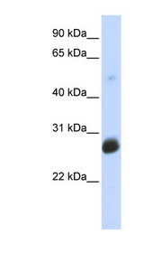 RNF186 antibody LS-C102015 Western blot of Transfected 293T cell lysate.
