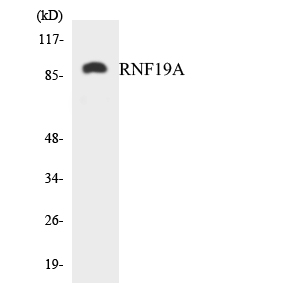 Western blot of the lysates from Jurkat cells using RNF19A antibody.