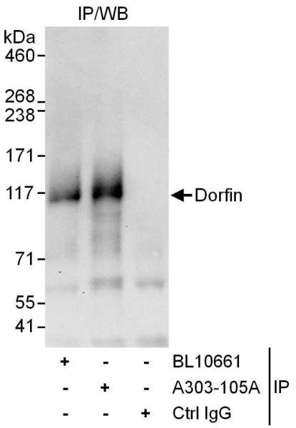 Detection of Human Dorfin by Western Blot of Immunoprecipitates. Samples: Whole cell lysate (1 mg for IP, 20% of IP loaded) from HeLa cells. Antibodies: Affinity purified rabbit anti-Dorfin antibody used for IP at 6 ug/mg lysate. Dorfin was also immunoprecipitated by rabbit anti-Dorfin antibody BL10661, which recognizes an upstream epitope. For blotting immunoprecipitated Dorfin, was used at 1 ug/ml. Detection: Chemiluminescence with an exposure time of 30 seconds.