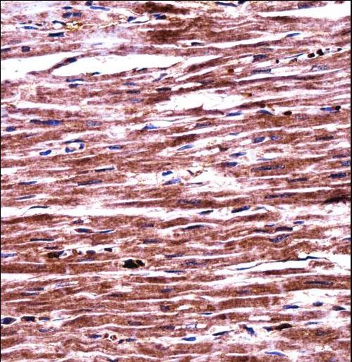RNF19A Antibody immunohistochemistry of formalin-fixed and paraffin-embedded human heart tissue followed by peroxidase-conjugated secondary antibody and DAB staining.