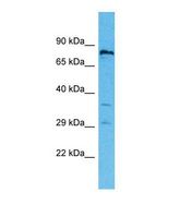 Western blot of Human 721_B. RNF19B antibody dilution 1.0 ug/ml.