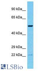 RNF19B antibody Western Blot of Jurkat. Antibody dilution: 1 ug/ml.