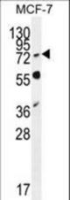 RNF19B Antibody western blot of MCF-7 cell line lysates (35 ug/lane). The RNF19B antibody detected the RNF19B protein (arrow).