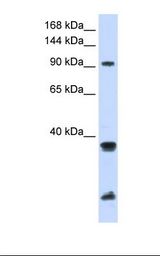 MCF7 cell lysate. Antibody concentration: 1.0 ug/ml. Gel concentration: 6-18%.