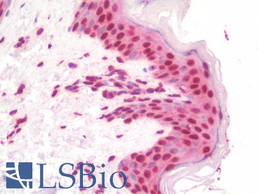 Anti-RNF20 antibody IHC staining of human skin. Immunohistochemistry of formalin-fixed, paraffin-embedded tissue after heat-induced antigen retrieval. Antibody LS-B10108 concentration 10 ug/ml.
