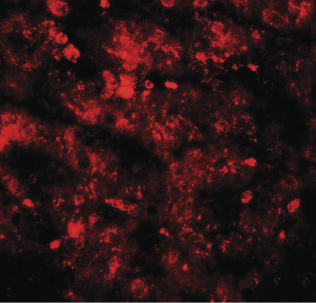 Immunofluorescence of RNF20 in human liver tissue with RNF20 antibody at 20 ug/ml.