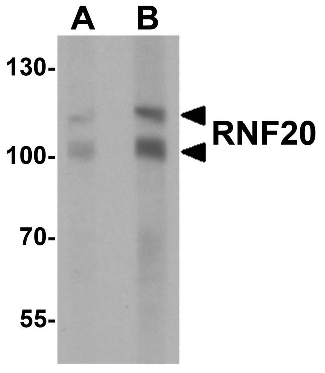 Western blot analysis of RNF20 in human liver tissue lysate with RNF20 antibody at (A) 1 and (B) 2 ug/ml.
