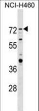 RNF207 Antibody western blot of NCI-H460 cell line lysates (35 ug/lane). The RNF207 antibody detected the RNF207 protein (arrow).