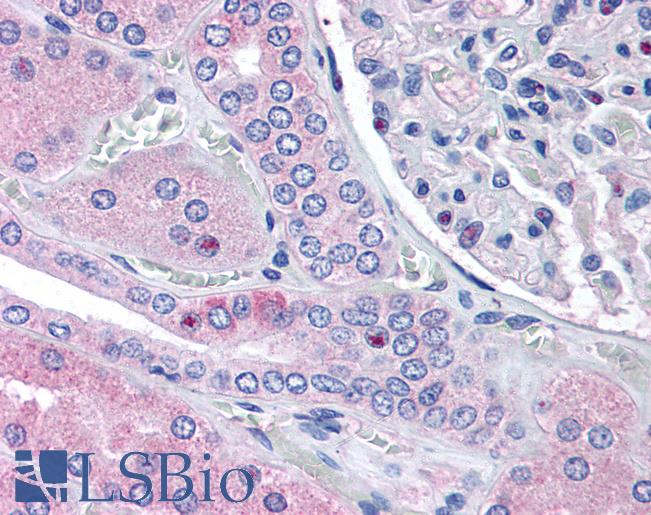 Anti-RNF213 antibody IHC of human kidney. Immunohistochemistry of formalin-fixed, paraffin-embedded tissue after heat-induced antigen retrieval. Antibody LS-B1755 concentration 5 ug/ml.