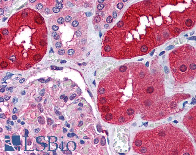 Anti-RNF213 antibody IHC of human kidney. Immunohistochemistry of formalin-fixed, paraffin-embedded tissue after heat-induced antigen retrieval. Antibody LS-B1757 concentration 25 ug/ml.