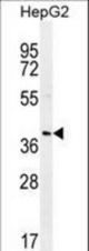 RNF215 Antibody western blot of HepG2 cell line lysates (35 ug/lane). The RNF215 antibody detected the RNF215 protein (arrow).