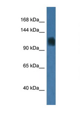 RAG1 antibody LS-C135124 Western blot of Mouse Liver lysate. Antibody concentration 1 ug/ml.