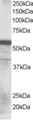 Antibody staining (0.1 ug/ml) of Human Lung lysate (RIPA buffer, 35 ug total protein per lane). Primary incubated for 1 hour. Detected by Western blot of chemiluminescence.