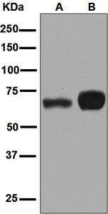 Western blot analysis on (A) fetal brain and (B) fetal thymus lysates using anti-RNF8 antibody.