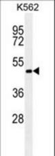 RNF8 antibody western blot of K562 cell line lysates (35 ug/lane). The RNF8 antibody detected the RNF8 protein (arrow).