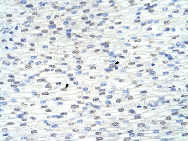 RNF8 antibody LS-C80297 was used in IHC to stain formalin-fixed, paraffin-embedded human heart.