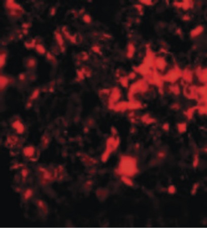 Immunofluorescence of RNF8 in rat lung tissue with RNF8 antibody at 20 ug/ml.