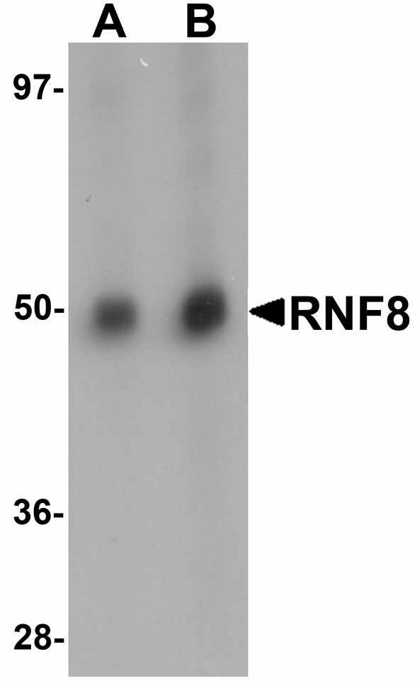 Western blot of RNF8 in human lung tissue lysate with RNF8 antibody at (A) and (B) 2 ug/ml.