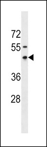 RNFT1 Antibody western blot of MDA-MB231 cell line lysates (35 ug/lane). The RNFT1 antibody detected the RNFT1 protein (arrow).
