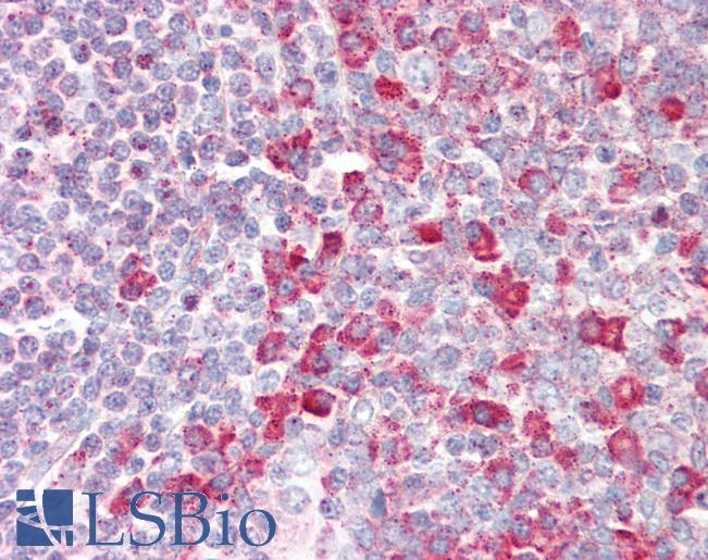 Anti-RNGTT / HCAP antibody IHC staining of human tonsil. Immunohistochemistry of formalin-fixed, paraffin-embedded tissue after heat-induced antigen retrieval.